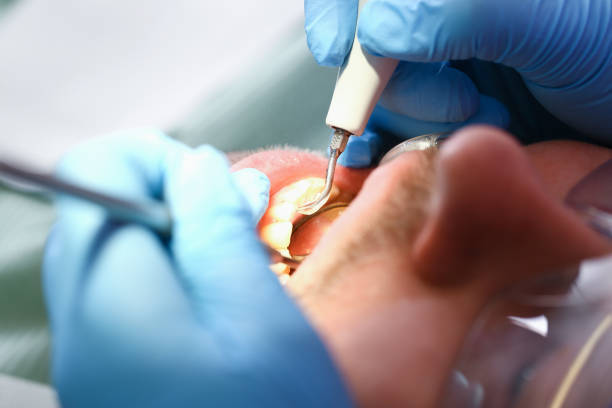 Best Tooth Pain Emergency Relief  in Moss Bluff, LA