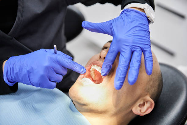 Best Broken Tooth Emergency  in Moss Bluff, LA